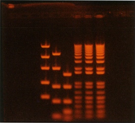 DNA Gel on Transilluminator (28,448 bytes)